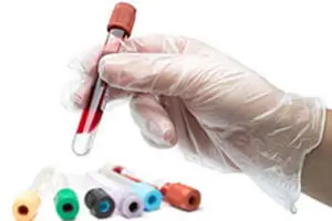 Xét nghiệm, khám chữa bệnh lậu ở đâu tốt nhất ở Hà Nội 16 địa chỉ