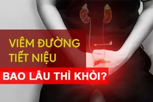 Viêm đường tiết niệu có lây không bao lâu thì khỏi? BÁC SĨ Lân Giải Đáp