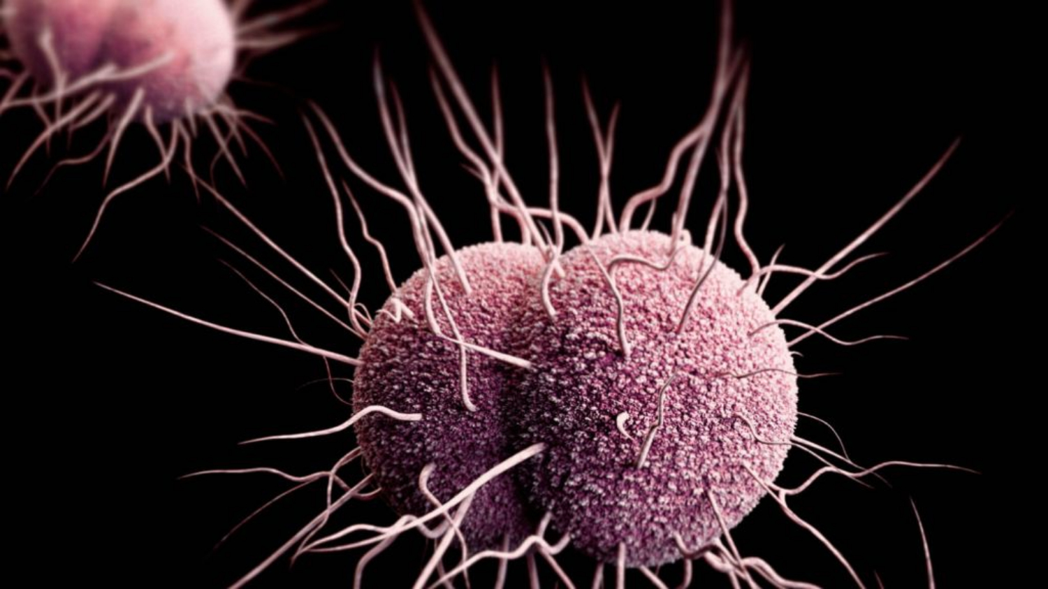 Bệnh lậu là gì? Nguyên nhân, Triệu chứng, Cách chữa bệnh lậu hiệu quả