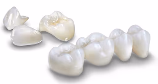 corone in zirconio e ceramica