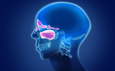 A CT scan of the sinuses