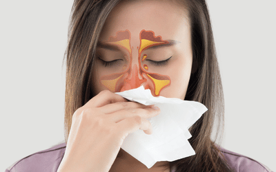 A woman holding a tissue to her nose with her sinuses outlined