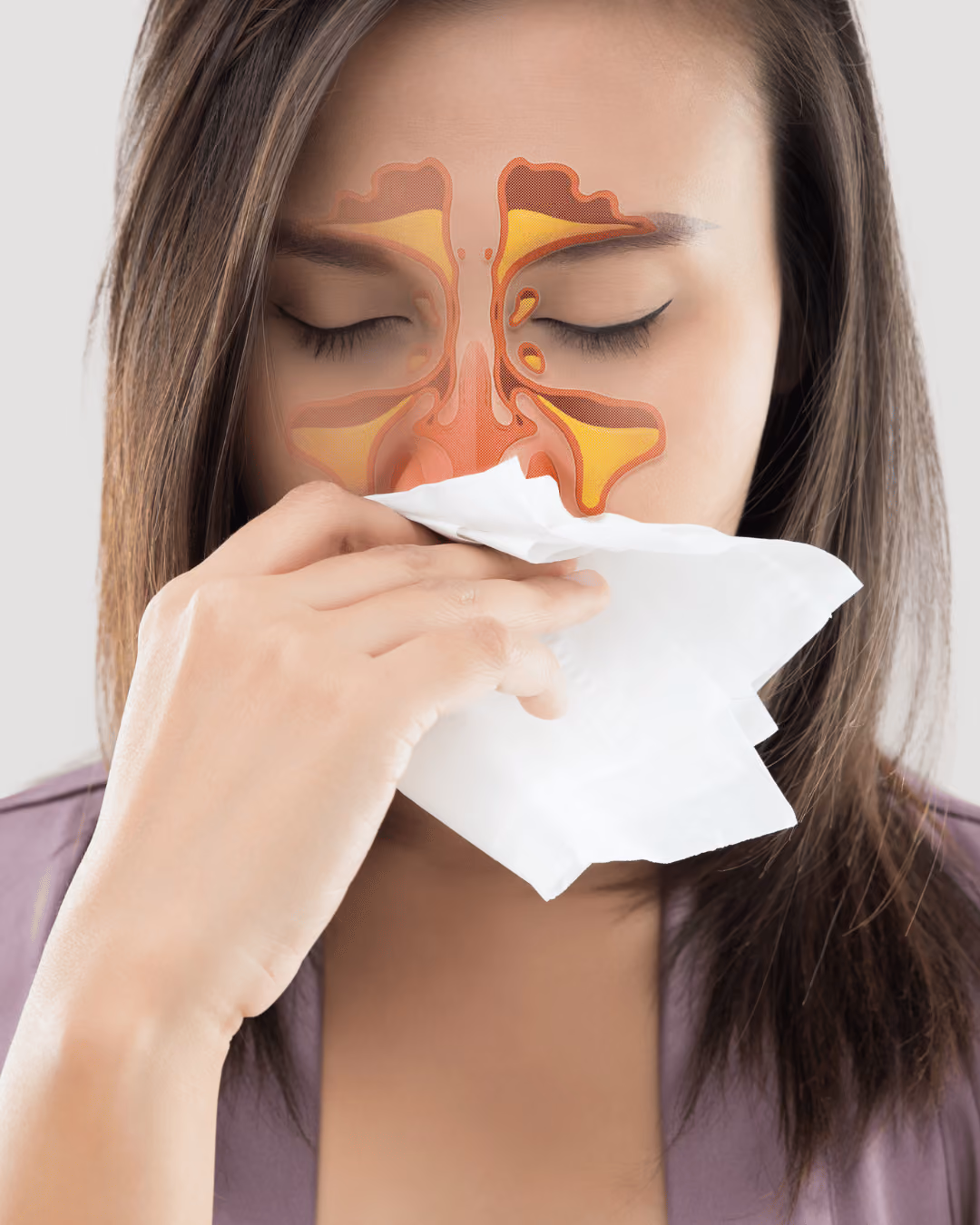 Woman holding tissue to her nose with an overlay of a graphic of her sinuses