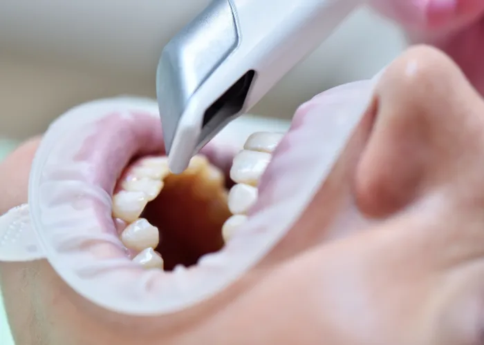 Zahnarzt scannt Zähne mit 3D-Scangerät.