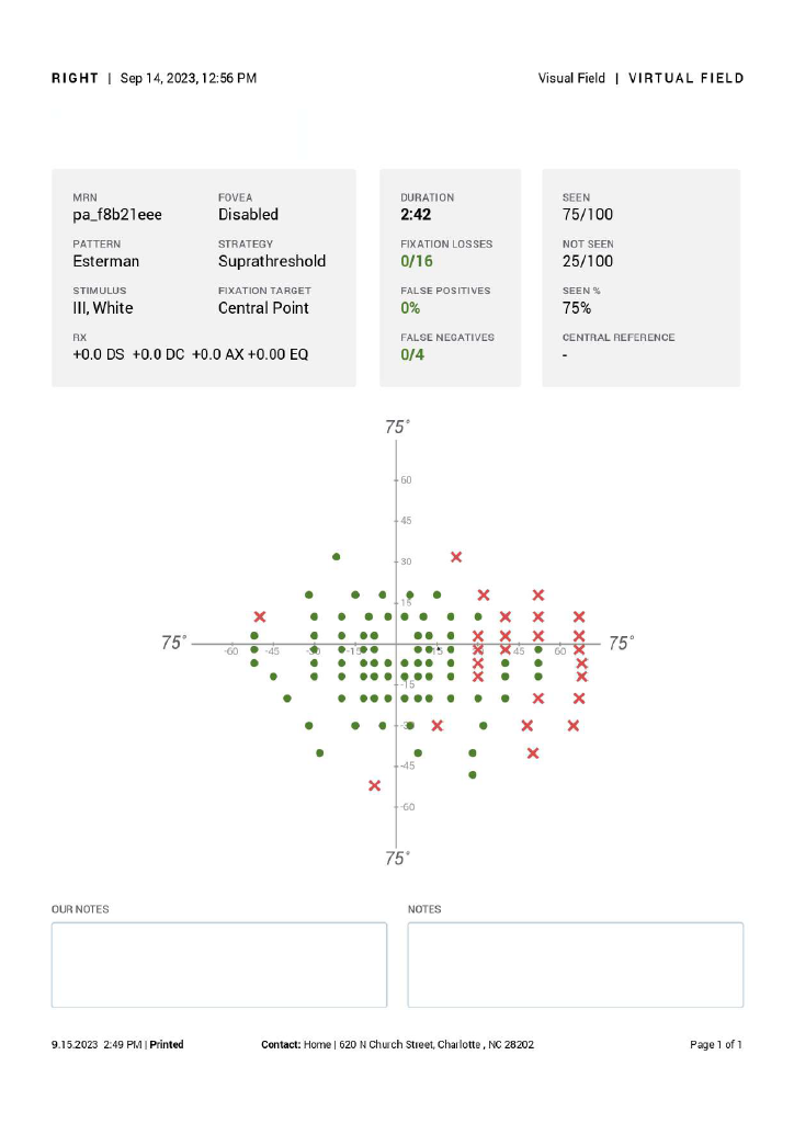 120-degree visual field test for driving example