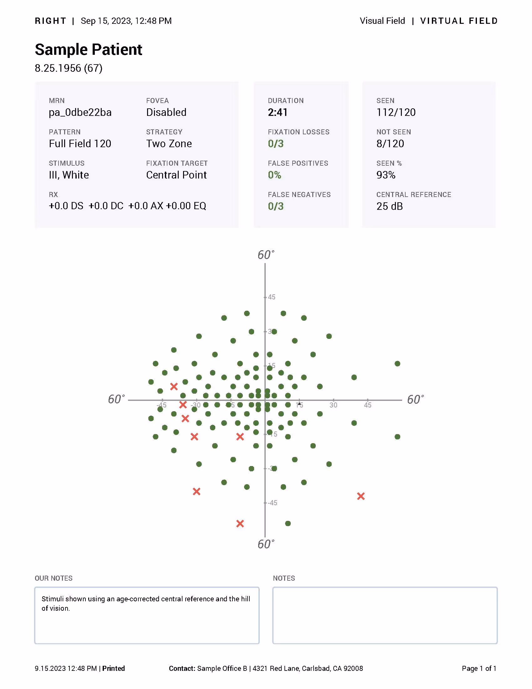 A samle Full Field 120 Report