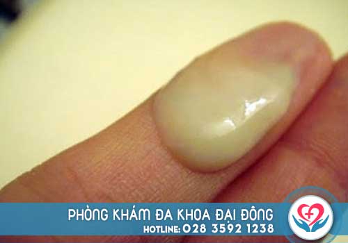 Kết quả hình ảnh cho Cách chữa khà hư mà u xanh tại nhÃ ÄÆ¡n giản