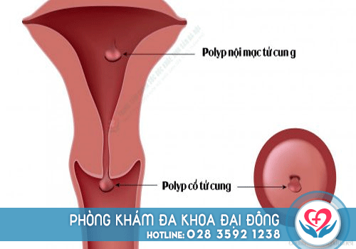 Káº¿t quáº£ hÃ¬nh áº£nh cho 1 thÃ¡ng cÃ³ kinh 3 láº§n cÃ³ sao khÃ´ng da khoa dai dong