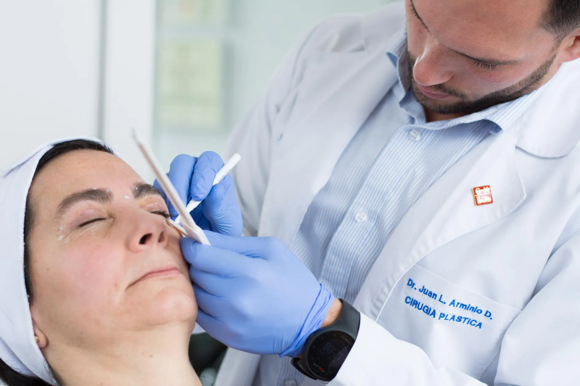Blefaroplastia o lifting de cejas: ¿Cuál es el ideal para ti?

Cuando se trata de rejuvenecer la mirada, muchas personas pueden sentirse indecisas entre una blefaroplastia o un lifting de cejas. Ambos procedimientos están diseñados para revitalizar el área de los ojos, pero cumplen funciones distintas y están indicados en situaciones específicas. Es frecuente que se confundan debido a que ambos afectan la apariencia de la zona ocular y pueden contribuir a una mirada más joven y descansada. A continuación, exploramos las diferencias clave entre estos procedimientos y te orientamos para que determines cuál es más adecuado para ti.

La blefaroplastia, también conocida como cirugía de párpados, se centra en eliminar el exceso de piel y grasa en los párpados superiores e inferiores. Esto ayuda a reducir la apariencia de párpados caídos y bolsas debajo de los ojos, logrando una mirada más despierta. Es ideal para personas que experimentan flacidez en los párpados, ya sea por factores genéticos o por el paso del tiempo.

Por otro lado, el lifting de cejas es un procedimiento enfocado en elevar las cejas y suavizar las arrugas de la frente. Está indicado para quienes han notado que sus cejas han descendido con el tiempo, lo que puede dar una expresión de cansancio o tristeza. Al levantar las cejas, el lifting abre la mirada y proporciona una apariencia más fresca y joven.

Diferencias clave entre blefaroplastia y lifting de cejas
Aunque la blefaroplastia y el lifting de cejas tienen el objetivo común de rejuvenecer la mirada, su enfoque y resultados son distintos. La blefaroplastia se enfoca en mejorar la apariencia de los párpados, eliminando el exceso de piel y grasa en la zona de los ojos. Su principal objetivo es reducir las bolsas y la flacidez en los párpados, creando una apariencia más descansada y joven. Este procedimiento es adecuado para quienes presentan párpados caídos o bolsas bajo los ojos que no pueden corregirse mediante tratamientos menos invasivos.

Por otro lado, el lifting de cejas tiene como objetivo principal elevar y tensar las cejas y la frente. Es una opción ideal para personas con cejas caídas o que desean reducir las arrugas en la frente. Al elevar las cejas, el lifting proporciona un aspecto rejuvenecido, abriendo la mirada y mejorando la expresión facial. A diferencia de la blefaroplastia, el lifting de cejas se enfoca en la posición de las cejas y en tensar la piel de la frente.

¿Cuándo elegir una blefaroplastia y cuándo un lifting de cejas?
La elección entre una blefaroplastia o un lifting de cejas dependerá de tus necesidades y características individuales. Aquí te damos algunas recomendaciones generales:

Si tienes párpados caídos o bolsas bajo los ojos: La blefaroplastia es la mejor opción, ya que permite eliminar el exceso de piel y grasa en el área de los ojos.
Si tus cejas están descendidas o tienes arrugas en la frente: El lifting de cejas es ideal para elevar las cejas y reducir las líneas horizontales en la frente, logrando una mirada más abierta.
Ambos problemas: En algunos casos, los pacientes pueden beneficiarse de una combinación de ambos procedimientos para un rejuvenecimiento completo de la mirada.
La importancia de una valoración profesional
Cada caso es único, y la mejor manera de determinar qué procedimiento es adecuado para ti es a través de una valoración profesional con un cirujano plástico certificado. Durante la consulta, el especialista evaluará tus necesidades y te guiará para encontrar la opción más adecuada según tus características faciales y tus expectativas.

Conclusión
Elegir entre una blefaroplastia y un lifting de cejas dependerá de tus necesidades específicas y de los resultados que deseas obtener. Ambos procedimientos ofrecen beneficios estéticos significativos y pueden transformar la mirada, pero cada uno está indicado en situaciones particulares. Consulta con un cirujano plástico certificado que pueda ayudarte a determinar la opción ideal y guiarte hacia una apariencia rejuvenecida y natural.