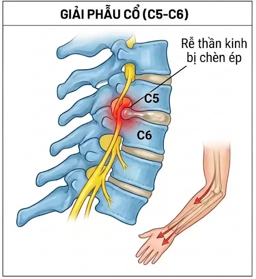 Giải phẫu đốt sống cổ