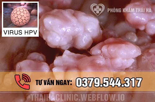 Bệnh sùi mào gà