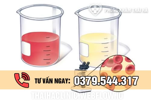 Đái (tiểu) ra máu là dấu hiệu bệnh gì?