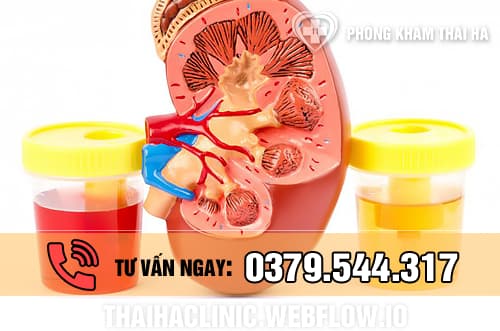 Đái (tiểu) ra máu là gì?
