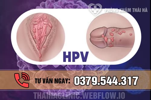 Các triệu chứng bệnh sùi mào gà thường gặp ở nam và nữ giớ