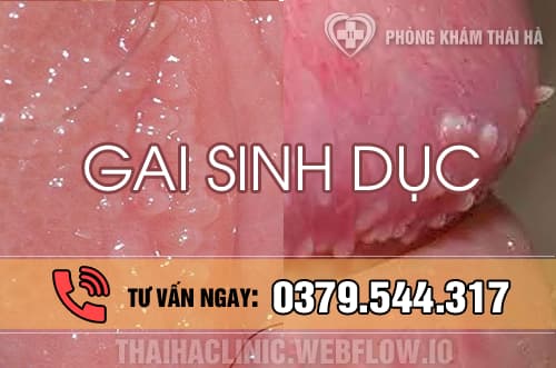 Gai sinh dục