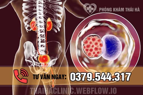 Biểu hiện viêm niệu đạo do bệnh lậu