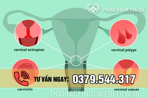 Nguyên nhân gây ra bệnh viêm cổ tử cung