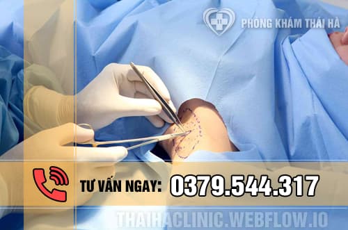 Chữa hôi nách vĩnh viễn bằng kỹ thuật hiện đại