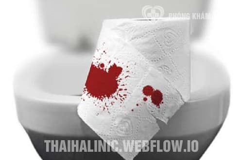 Đi ngoài ra máu tươi là bệnh gì