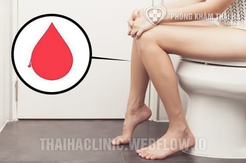 Đi đại tiện ra máu tươi nhưng không đau là bệnh gì?