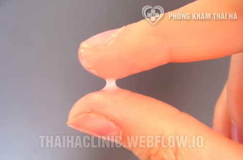 Khí hư màu trắng sữa