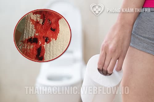 Đi ngoài ra máu có nguy hiểm không?