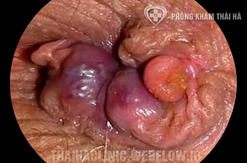 So do phan biet tri noi va tri ngoai