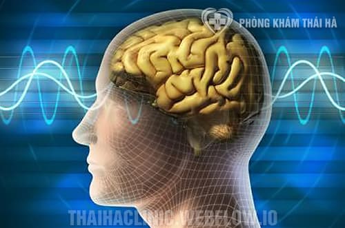 Hội chứng não cá vàng