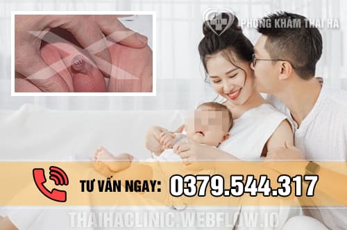 Trẻ mấy tuổi thì nên cắt bao quy đầu?