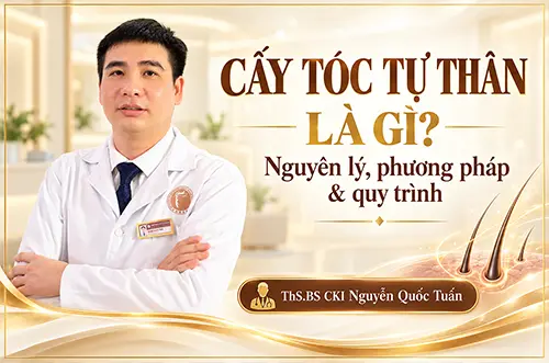 Bác sĩ giải đáp cấy tóc tự thân là gì? nguyên lý, phương pháp và quy trình của kỹ thuật này