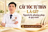 Cấy Tóc Tự Thân Là Gì? Nguyên Lý, Phương Pháp & Quy Trình