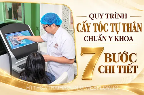 Bác sĩ Thọ tư vấn chi tiết 7 bước quy trình cấy tóc tự thân chuẩn y khoa