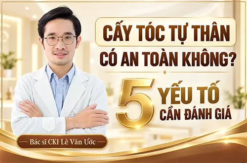 Bác sĩ Ước giải đáp cấy tóc tự thân có thực sự an toàn không?