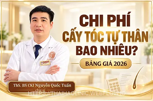 Bác sĩ giải đáp chi phí cấy tóc tự thân hết bao nhiêu tiền