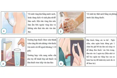 Cách vệ sinh vùng kín sau khi đặt thuốc đúng cách