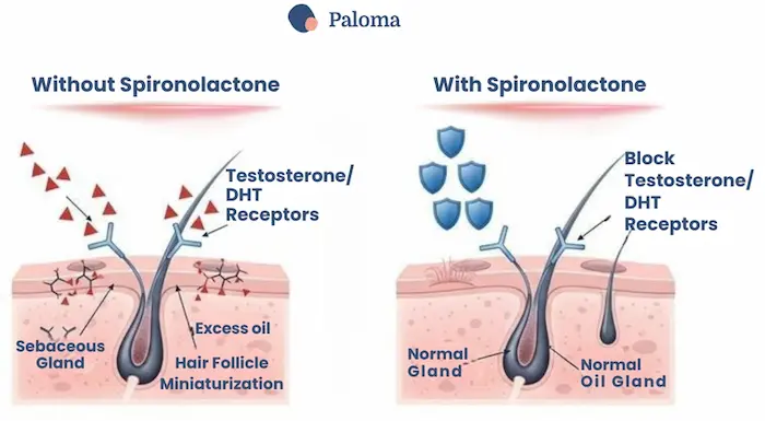 can spironolactone cause hair loss