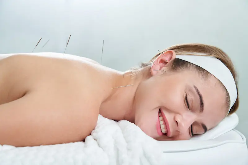 The Benefits of Acupuncture for Hormonal Health