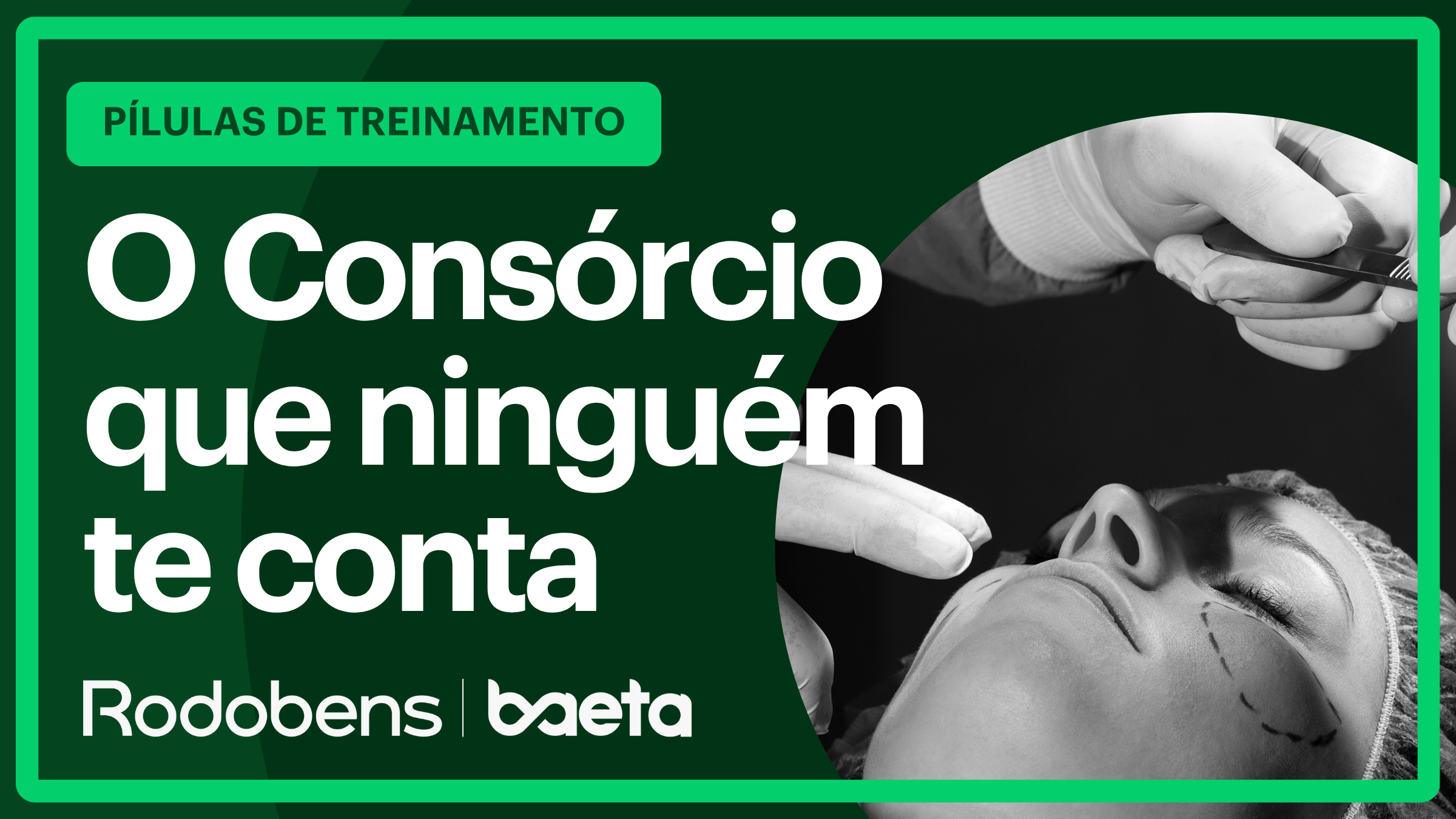 O Consórcio que ninguém te conta - Viagem, Plástica e Implante Capilar