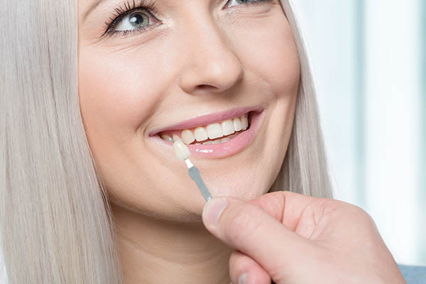 Smiling Woman and Veneers