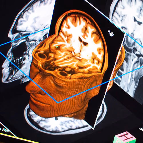 Functional magnetic resonance imaging (fMRI), Source: arselectronica, flickr.com
