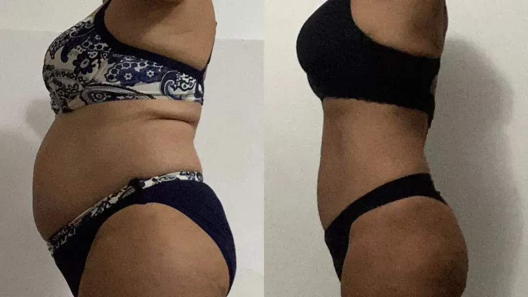 Photo avant-après d'une femme de 55 ans qui a perdu 12 kilos sans se priver de glucides.
