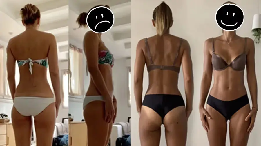 Photos avant-après d’une femme au départ skinny fat, qui a raffermi son corps non pas en éliminant une quelconque rétention d’eau, mais en perdant de la graisse et en gagnant de la masse musculaire.