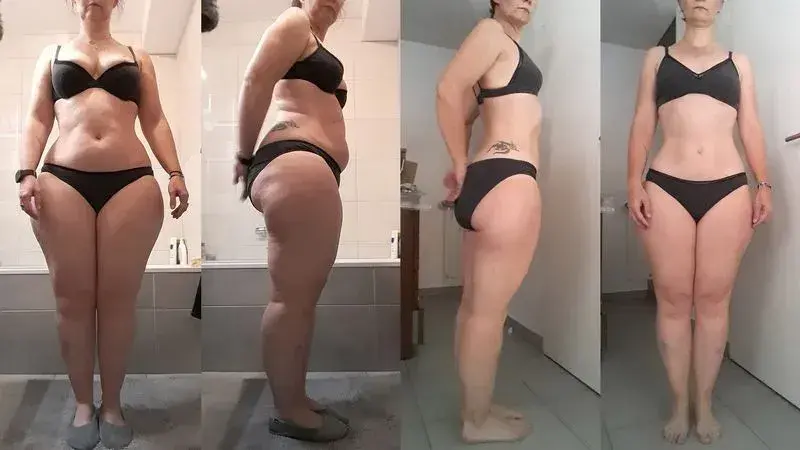 Photos avant-après d’une femme qui est parvenue à se débarrasser de l’aspect gonflé de son corps sans drainage lymphatique, simplement en perdant de la graisse.