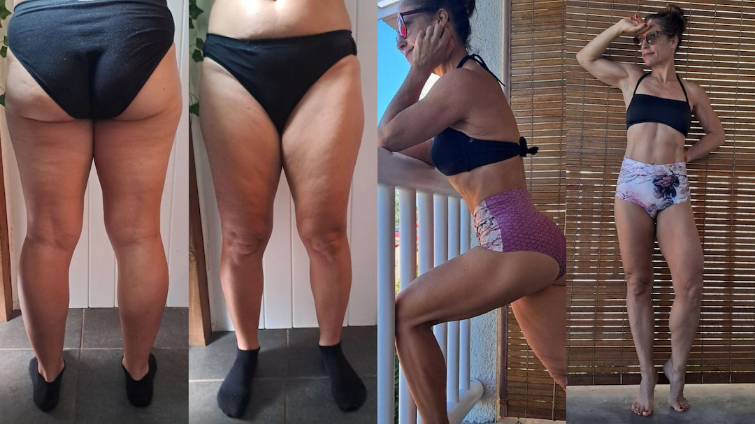 Femme de 50 ans qui a affiné ses cuisses et éliminé sa culotte de cheval.