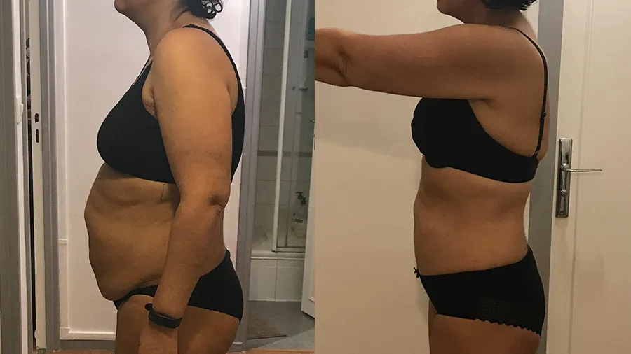 Amel, 40 ans, perte de poids avant après