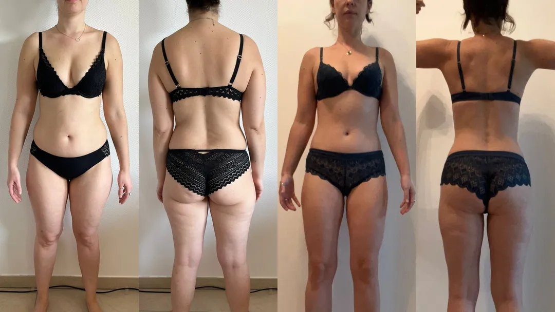 Photo avant-après après d'une femme qui a perdu des hanches