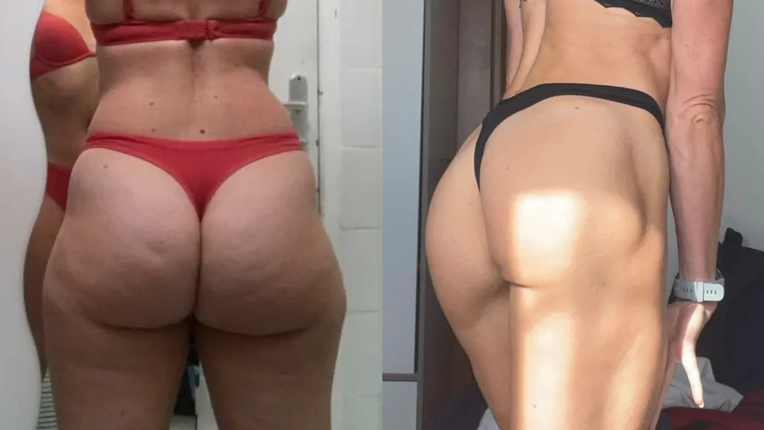 Photo avant après d'une femme qui a perdu sa culotte de cheval pour dessiner ses muscles des fessiers
