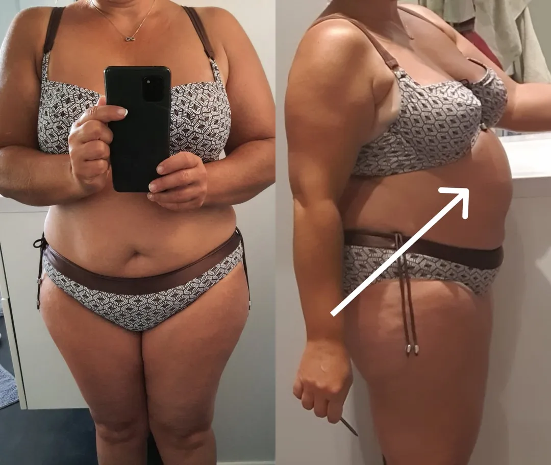 Femme de 40 ans avec de la graisse viscérale