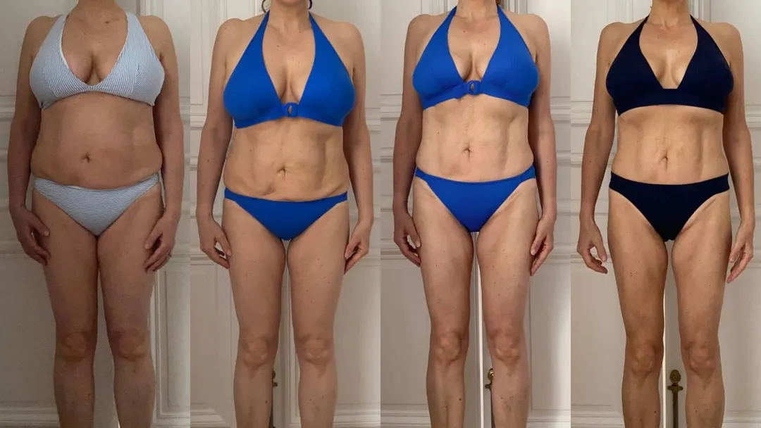 Photo avant-apres qui témoigne de la perte de poids d'une femme ménopausée, atteindre d'hypothyroïdie.
