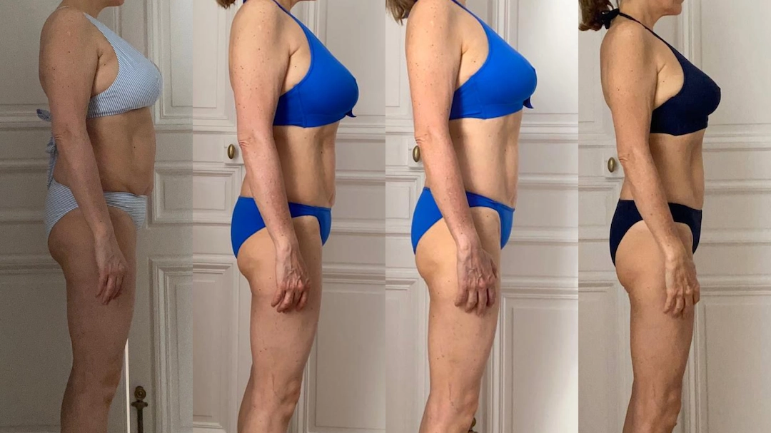 Photo avant-après de la perte de graisse du ventre d'une femme de 50 ans.